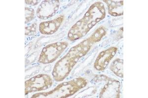 Immunohistochemistry of paraffin-embedded rat kidney using [KO Validated] NDUFB4 Rabbit pAb (ABIN6133349, ABIN6144476, ABIN6144477 and ABIN7101430) at dilution of 1:150 (40x lens). (NDUFB4 anticorps  (AA 1-90))