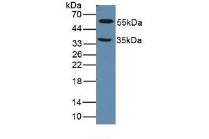 Detection of LOXL1 in Mouse Eye Tissue using Polyclonal Antibody to Lysyl Oxidase Like Protein 1 (LOXL1) (LOXL1 anticorps  (AA 392-598))