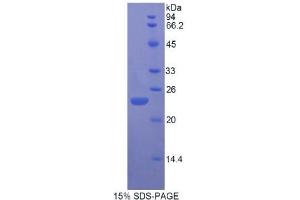 SDS-PAGE (SDS) image for Fibroblast Growth Factor 13 (FGF13) (AA 1-192) protein (His tag) (ABIN1821710)