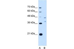 WB Suggested Anti-EVI2B Antibody Titration:  2. (EVI2B anticorps  (Middle Region))
