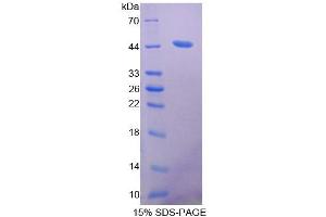 Image no. 1 for Acetyl-CoA Acetyltransferase 2 (ACAT2) (AA 1-397) protein (His tag) (ABIN6237444)