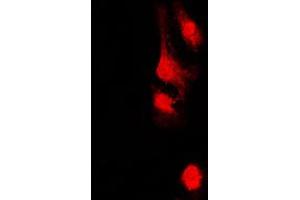 Immunofluorescent analysis of AKAP13 staining in HeLa cells. (AKAP13 anticorps  (Center))