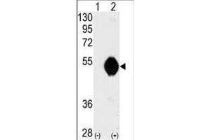 Western blot analysis of DOK2 (arrow) using DOK2 Antibody (C-term) (ABIN392072 and ABIN2841834).