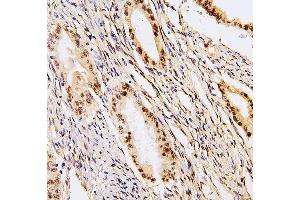 IHC analysis of PHF21A using anti-PHF21A antibody (ABIN6719353). (PHF21A anticorps  (AA 1-97))