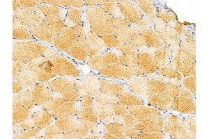 ABIN6257350 and ABIN6274727 at 1/100 staining Rat skin tissue by IHC-P. (MRPL11 anticorps  (Internal Region))