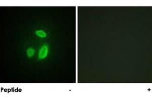 Immunofluorescence analysis of HUVEC cells, using ESPL1 polyclonal antibody . (Separase anticorps)
