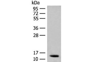 Western blot analysis of Human fetal brain tissue lysate using AKAP7 Polyclonal Antibody at dilution of 1:200 (AKAP7 anticorps)