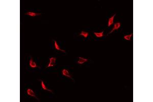 ABIN6268958 staining Hela by IF/ICC.