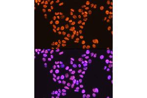 Immunofluorescence analysis of HeLa cells using TDP-43/TARDB Rabbit mAb (ABIN7270730) at dilution of 1:100 (40x lens). (TARDBP anticorps)