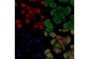 ABIN6266224 and ABIN6277495 staining Hela cells(heat shock treatment) by IF/ICC.
