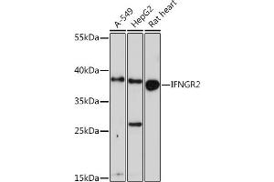 Western blot analysis of extracts of various cell lines, using IFNGR2 Rabbit pAb (ABIN6134791, ABIN6142199, ABIN6142201 and ABIN6218514) at 1:1000 dilution. (IFNGR2 anticorps  (C-Term))