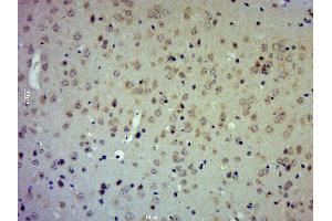 Paraformaldehyde-fixed, paraffin embedded mouse brain; Antigen retrieval by boiling in sodium citrate buffer (pH6.