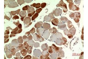 Immunohistochemistry (IHC) analysis of paraffin-embedded Human Muscle, antibody was diluted at 1:100.