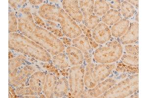 ABIN6267232 at 1/100 staining rat kidney tissue sections by IHC-P.