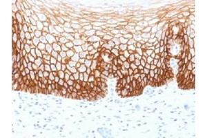 anti-CD44v9 antibody