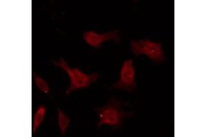 ABIN6267326 staining 293 by IF/ICC. (Tyrosine Hydroxylase anticorps  (pSer40))