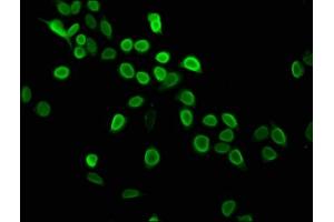 Immunofluorescence staining of Hela cells with ABIN7139604 at 1:2.