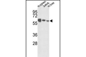Western blot analysis of IGFALS Antibody (Center) (ABIN391690 and ABIN2841595) in mouse spleen tissue, Jurkat cell line and mouse liver tissue lysates (35 μg/lane). (IGFALS anticorps  (AA 308-335))