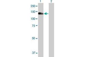 Lane 1: NLRP3 transfected lysate ( 118. (NLRP3 293T Cell Transient Overexpression Lysate(Denatured))