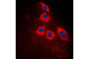 Immunofluorescent analysis of ARRDC3 staining in Jurkat cells. (ARRDC3 anticorps  (C-Term))