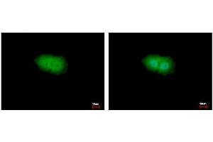 ICC/IF Image p90 RSK1 antibody detects p90 RSK1 protein at Cytoplasm and Nucleus by immunofluorescent analysis. (RPS6KA1 anticorps  (Center))