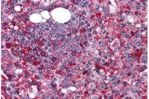 Human Spleen: Formalin-Fixed, Paraffin-Embedded (FFPE) (Anoctamin 2 anticorps  (N-Term))