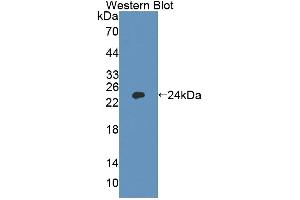 Western blot analysis of the recombinant protein. (Ninein anticorps  (AA 1-153))