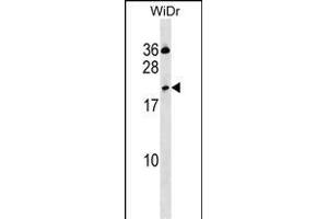 CLEC2D Antibody (Center) (ABIN1537750 and ABIN2850340) western blot analysis in WiDr cell line lysates (35 μg/lane). (CLEC2D anticorps  (AA 109-137))