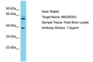 Image no. 1 for anti-MACRO Domain Containing 1 (MACROD1) (AA 83-132) antibody (ABIN6750601) (MACROD1 anticorps  (AA 83-132))