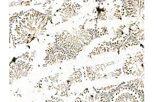 ABIN7094458 and ABIN7098506 at 1/100 staining Rat testis tissue by IHC-P.