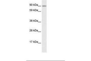 Image no. 1 for anti-Zinc Finger Protein 537 (ZNF537) (AA 466-515) antibody (ABIN6735913) (TSHZ3 anticorps  (AA 466-515))