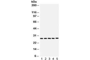 Western blot testing of 1) rat brain, 2) rat testis, 3) NEURO, 4) 293 and 5) SW620 lysate with SF2 antibody.