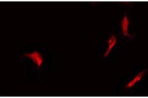 ABIN6268903 staining Hela by IF/ICC. (P18 INK anticorps)