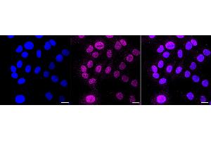 Immunocytochemical staining of HT- cells with Cullin 1 antibody (ABIN7798176), 1:1,000). (Recombinant Cullin 1 anticorps)