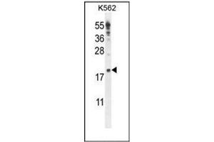 Western blot analysis of IQCJ Antibody (C-term) in K562 cell line lysates (35ug/lane). (IQCJ anticorps  (C-Term))