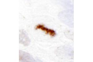 Immunohistochemistry (IHC) image for anti-Aurora Kinase B (AURKB) (C-Term) antibody (ABIN7448917)