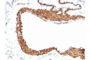 Formalin-fixed, paraffin-embedded rat lung stained with ACTA2 antibody (1A4 + ACTA2/791).