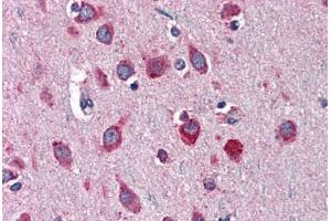 Human Brain, Cortex: Formalin-Fixed, Paraffin-Embedded (FFPE)