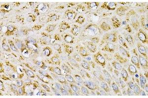Immunohistochemistry of paraffin-embedded Human esophagus using EFNA1 Polyclonal Antibody at dilution of 1:100 (40x lens).