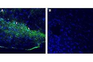 Expression of Opsin 3 in rat optic tract.