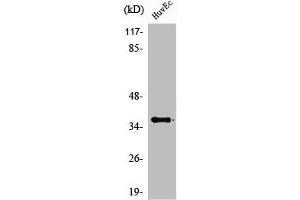 Western Blot analysis of HuvEc cells using ACOT8 Polyclonal Antibody (ACOT8 anticorps  (Internal Region))