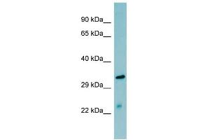 WB Suggested Anti-MASP2 Antibody Titration:  0. (MASP2 anticorps  (N-Term))