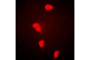 Immunofluorescent analysis of FHL-1 staining in Hela cells. (FHL1 anticorps)