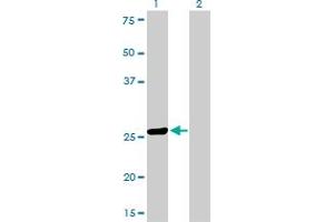 Western Blot analysis of TGIF2 expression in transfected 293T cell line by TGIF2 monoclonal antibody (M01), clone 4C10.
