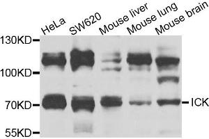 Western blot analysis of extracts of various cells, using ICK antibody.