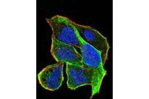 Immunofluorescence analysis of Hela cells using RND3 mouse mAb (green). (RND3 anticorps  (AA 104-241))
