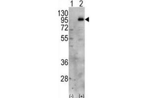 Western Blotting (WB) image for anti-Phosphatidylinositol-4-Phosphate 5-Kinase, Type I, gamma (PIP5K1C) antibody (ABIN3003648) (PIP5K1C anticorps)