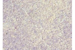 Immunohistochemistry of paraffin-embedded human thymus tissue using ABIN7170393 at dilution of 1:100 (SNX32 anticorps  (AA 144-403))