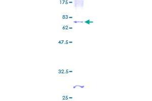 Image no. 1 for Carbohydrate (N-Acetylglucosamine 6-O) Sulfotransferase 4 (CHST4) (AA 1-370) protein (GST tag) (ABIN1349441)