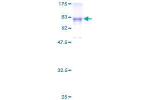 Image no. 1 for Prune Exopolyphosphatase (PRUNE) (AA 1-453) protein (GST tag) (ABIN1316496)